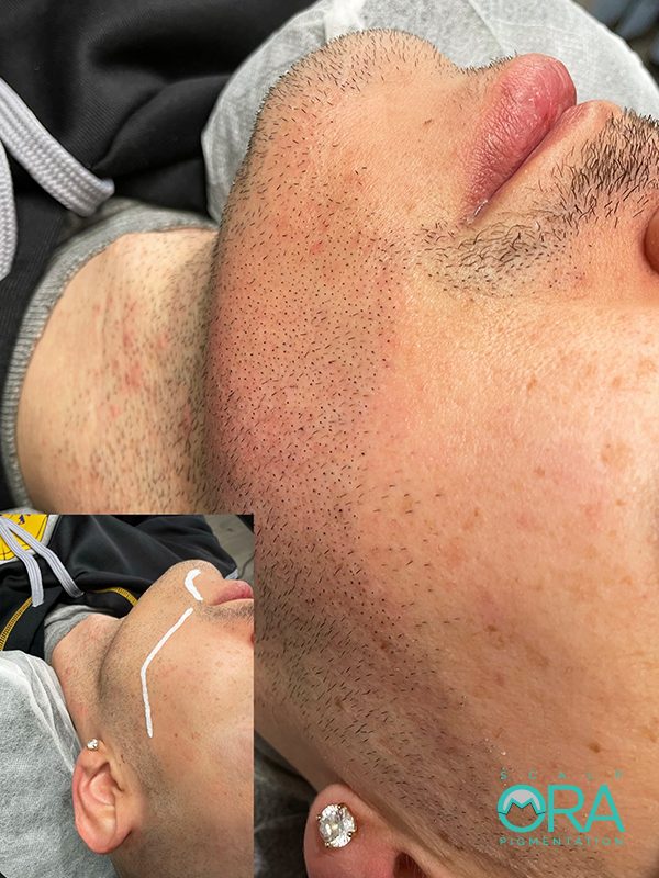 Beard restoration by Daniel Mora
